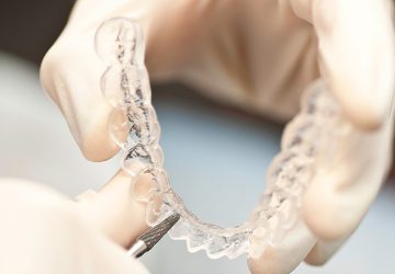 benefits of invisalign brisbane