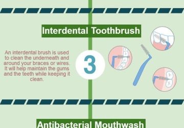 how to brush with braces