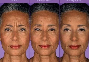 dental facial aesthetics in brisbane