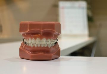 tooth model with braces on a bench