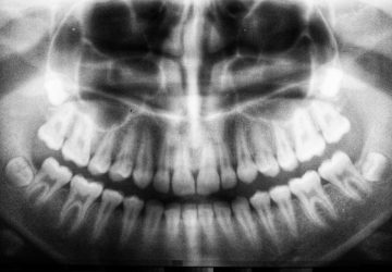 dental xray
