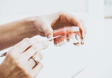 greenslopes dental implants brisbane