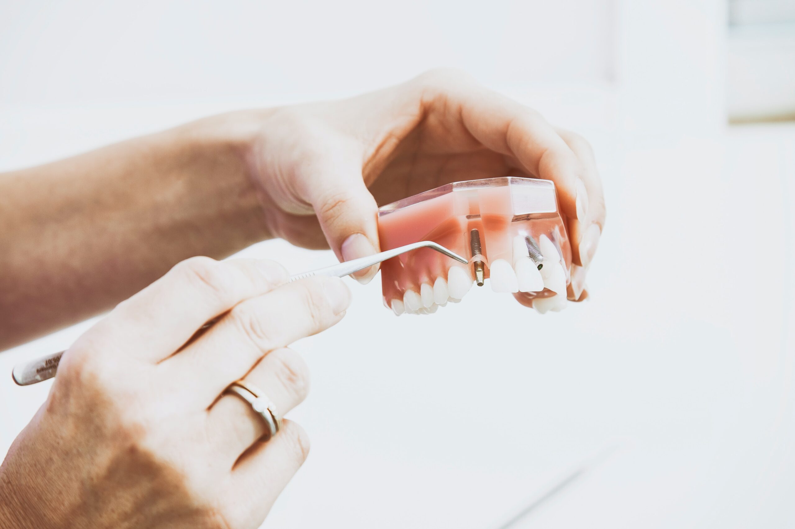 greenslopes dental implants brisbane