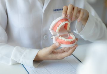 Dentists hold dental models used for dental care consultations,