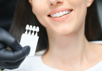 Doctor matching patient's dental veneers color with palette, closeup. Cosmetic dentistry