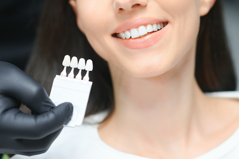 Doctor matching patient's dental veneers color with palette, closeup. Cosmetic dentistry