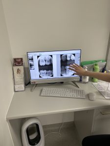 ALL IN 4 IMPLANTS TECHNOLOGY BRISBANE
