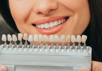 teeth palette with different shades of teeth near female smiling. Stomatology, whitening teeth, tooth implant