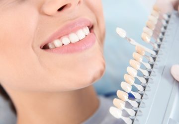 Dentist selecting patient's teeth color with palette in clinic, closeup