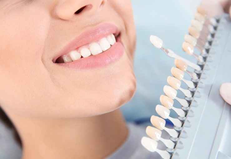 Dentist selecting patient's teeth color with palette in clinic, closeup