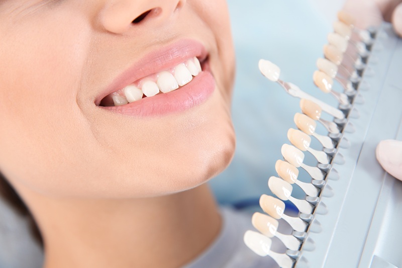 Dentist selecting patient's teeth color with palette in clinic, closeup