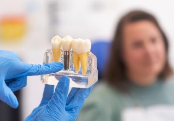 dental implants, dentist discussing a treatment plan with patient holds a dental implant model, emphasizing the importance of patient education in modern dental clinics.