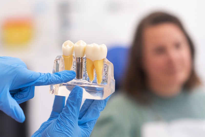 dental implants, dentist discussing a treatment plan with patient holds a dental implant model, emphasizing the importance of patient education in modern dental clinics.