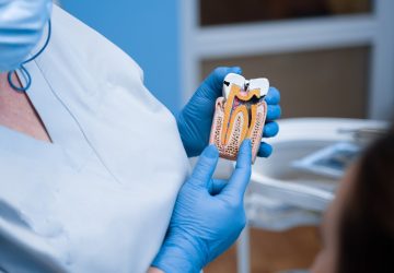 dental professional explains root canal anatomy
