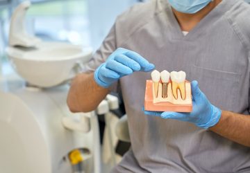 Cropped photo of man in medical uniform and rubber gloves holding a plastic model of teeth with an implant