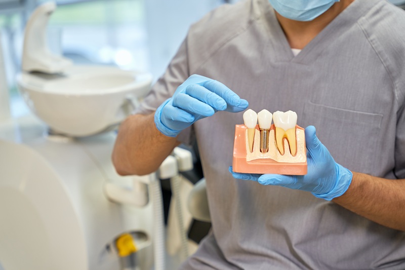 Cropped photo of man in medical uniform and rubber gloves holding a plastic model of teeth with an implant