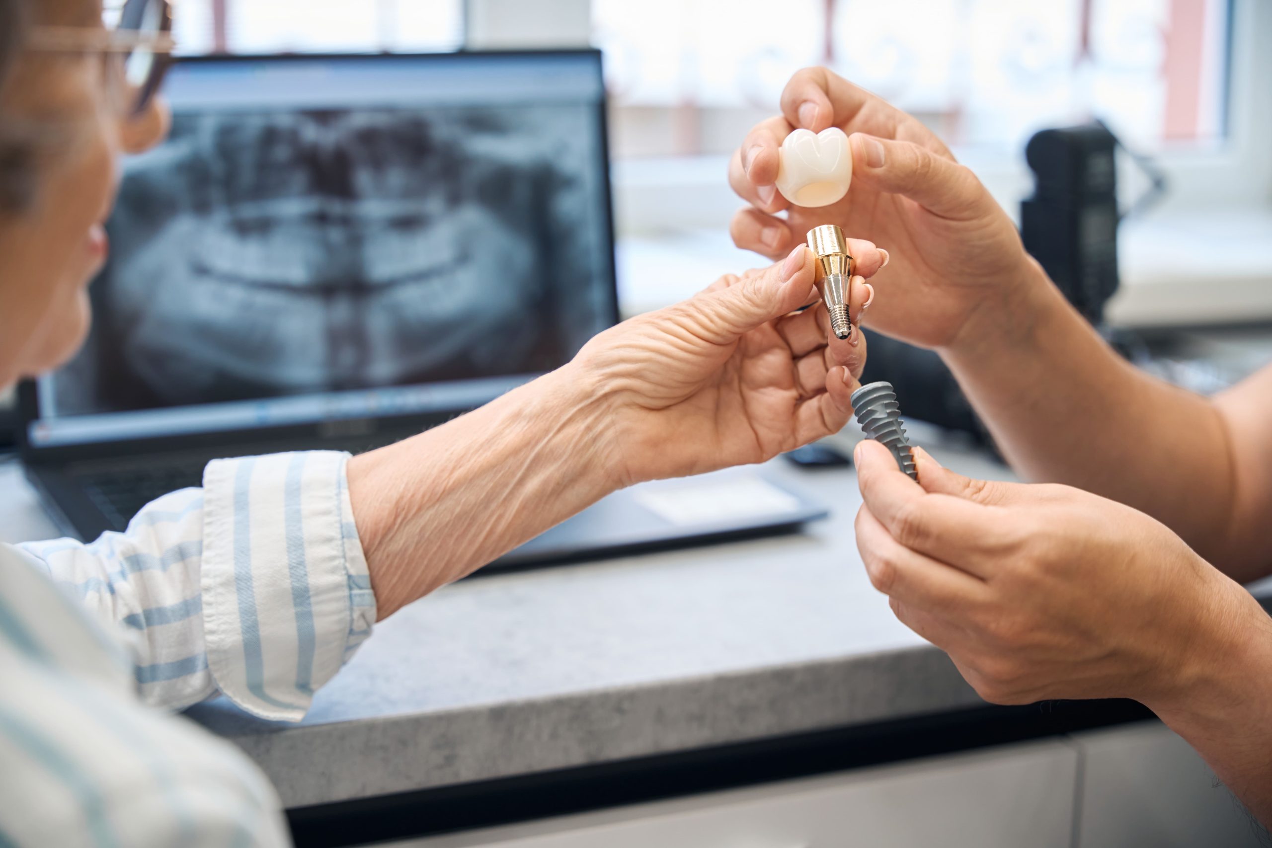 Dentist showing a senior patient a dental implant, abutment and crown during a consultation about whether All-on-4 implants are removable