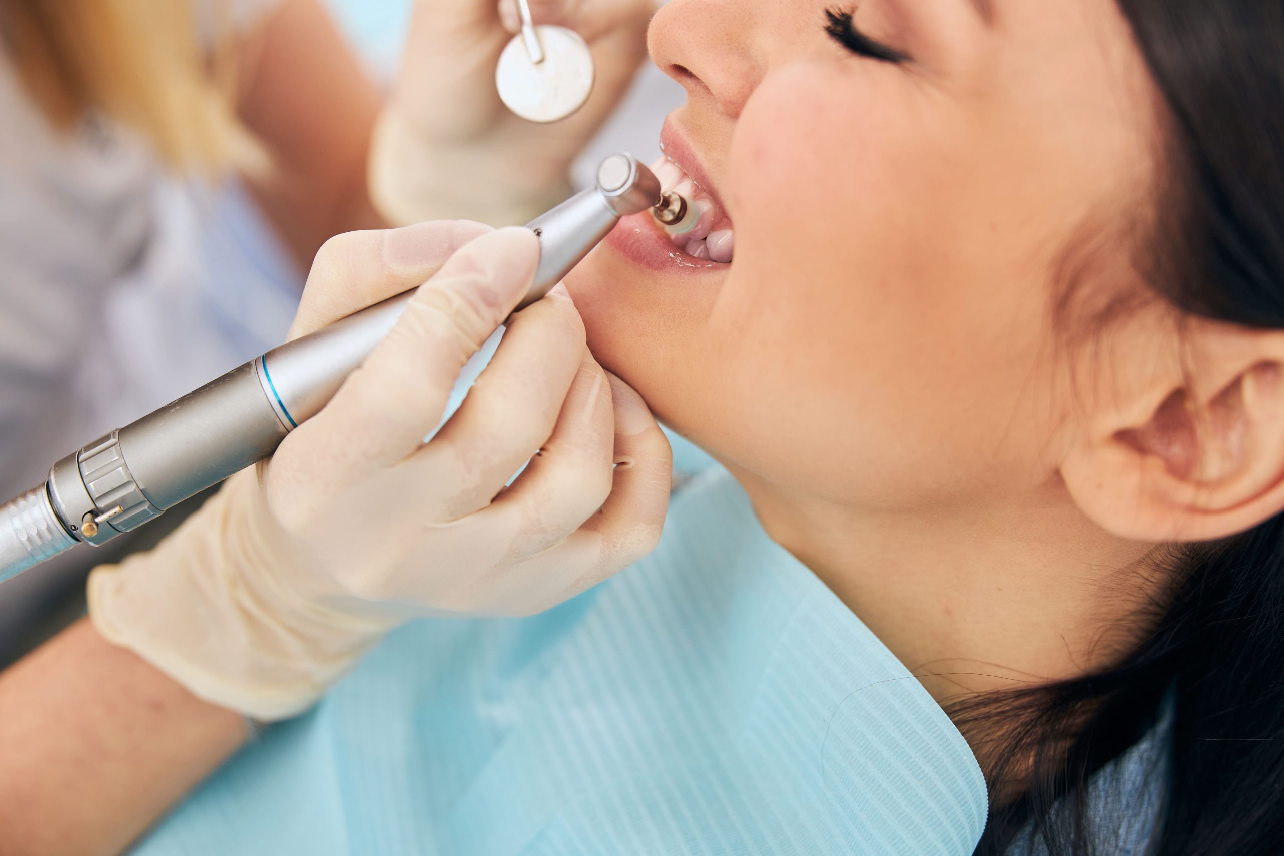 Dental hygienist using a polishing handpiece and mouth mirror during a dental cleaning for a relaxed female patient