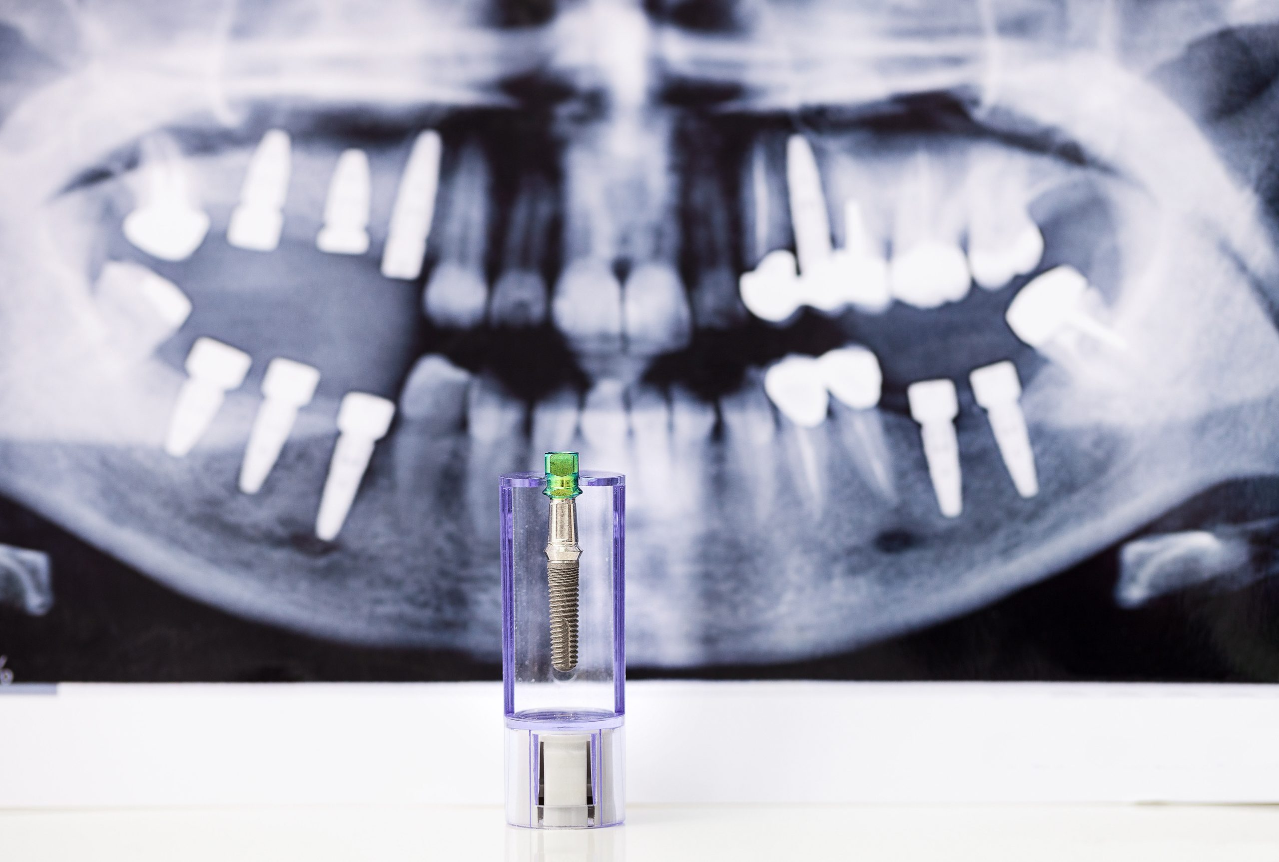 Titanium dental implant model in a clear display holder in front of a panoramic X-ray showing several dental implants, illustrating All-on-4 dental implants.