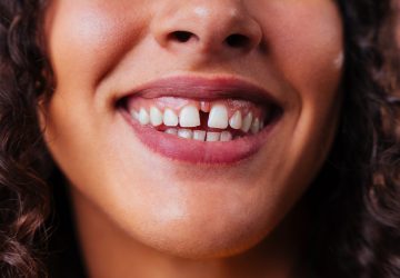 Close-up of a smiling woman with a noticeable gap between her upper front teeth