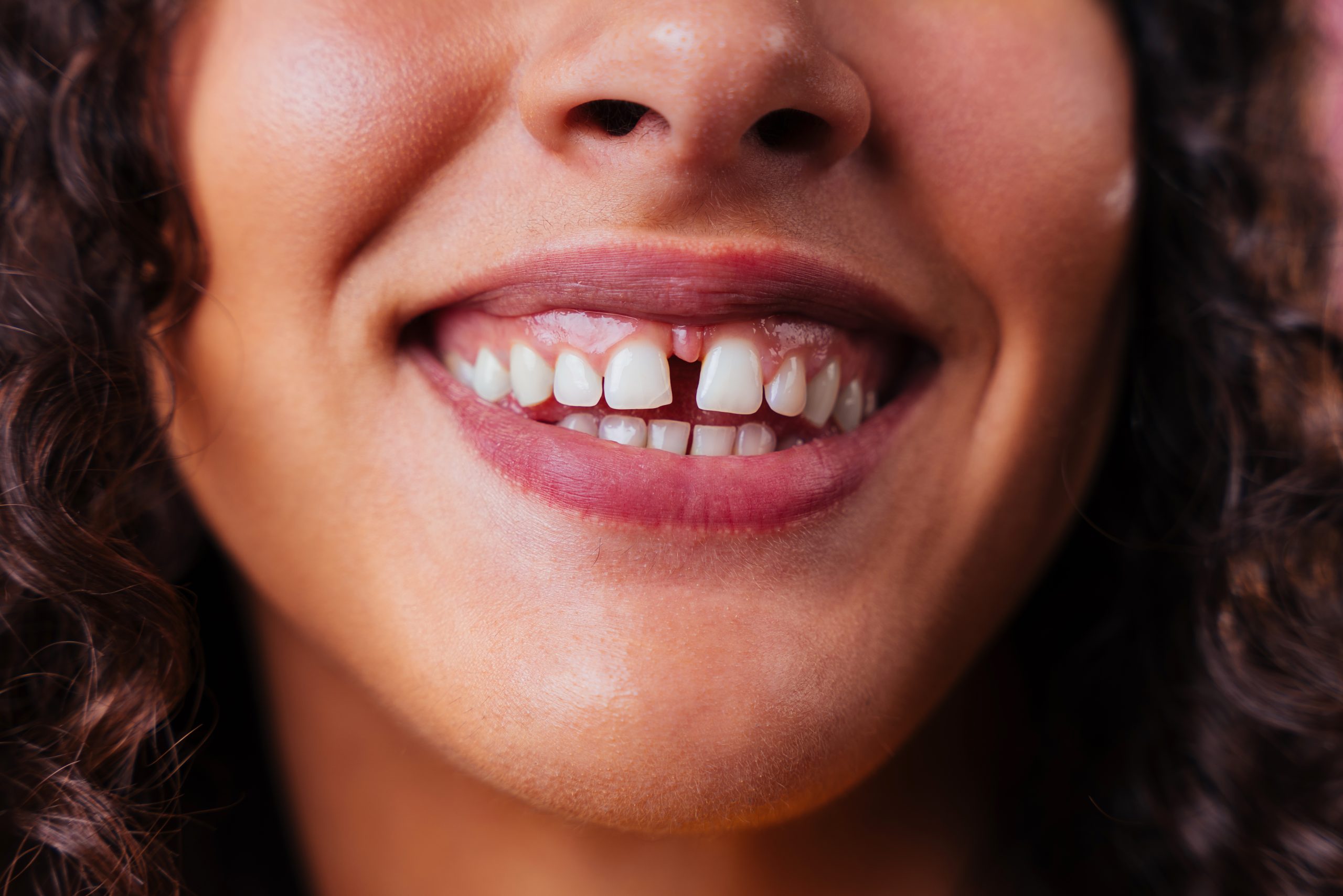 Close-up of a smiling woman with a noticeable gap between her upper front teeth