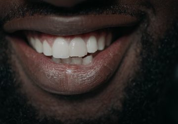 Close-up of a man’s smile showing a small chipped tooth on the biting edge of an upper front tooth
