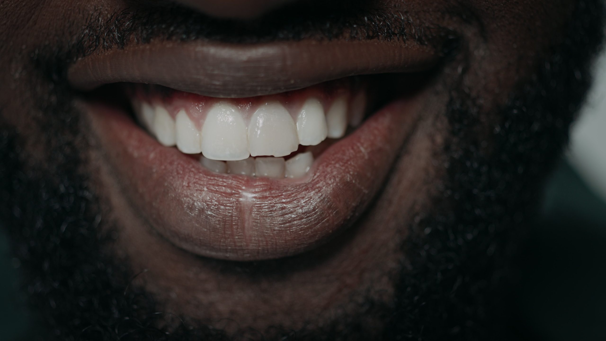 Close-up of a man’s smile showing a small chipped tooth on the biting edge of an upper front tooth